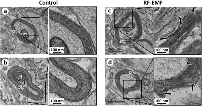 RF-EMF induces hyperactivity, autophagy, and demyelination in the cortical neurons of mice
